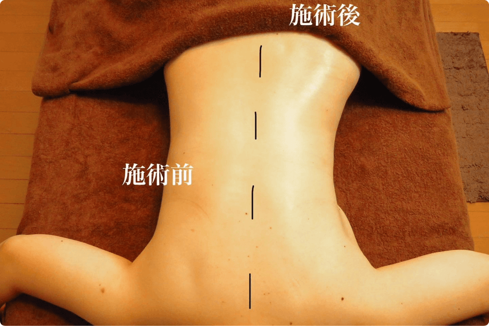 施術前、背術語
